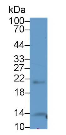 Western Blot THRSP Antibody