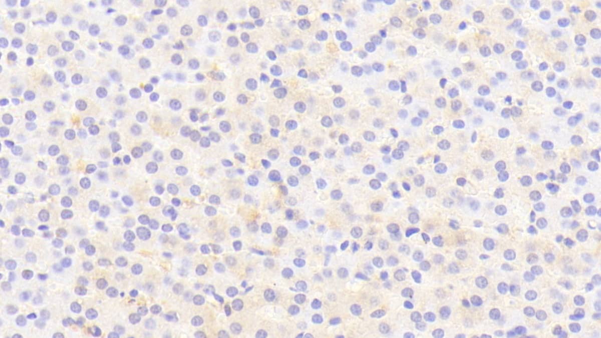 Immunohistochemistry-Paraffin: THRSP Antibody [NBP3-41241] - DAB staining on IHC-P; Samples: Human Liver Tissue; Primary Ab: 20ug/ml NBP3-41241; Second Ab: 2ug/mL HRP-Linked Caprine Anti-Rabbit IgG Polyclonal Antibody