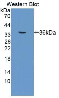 Western Blot Thromboxane A2 R/TBXA2R Antibody