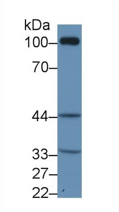 Western Blot Thromboxane A2 R/TBXA2R Antibody