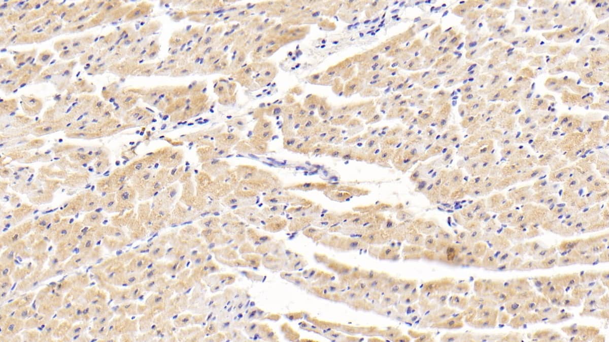 Immunohistochemistry-Paraffin TNKS2 Antibody