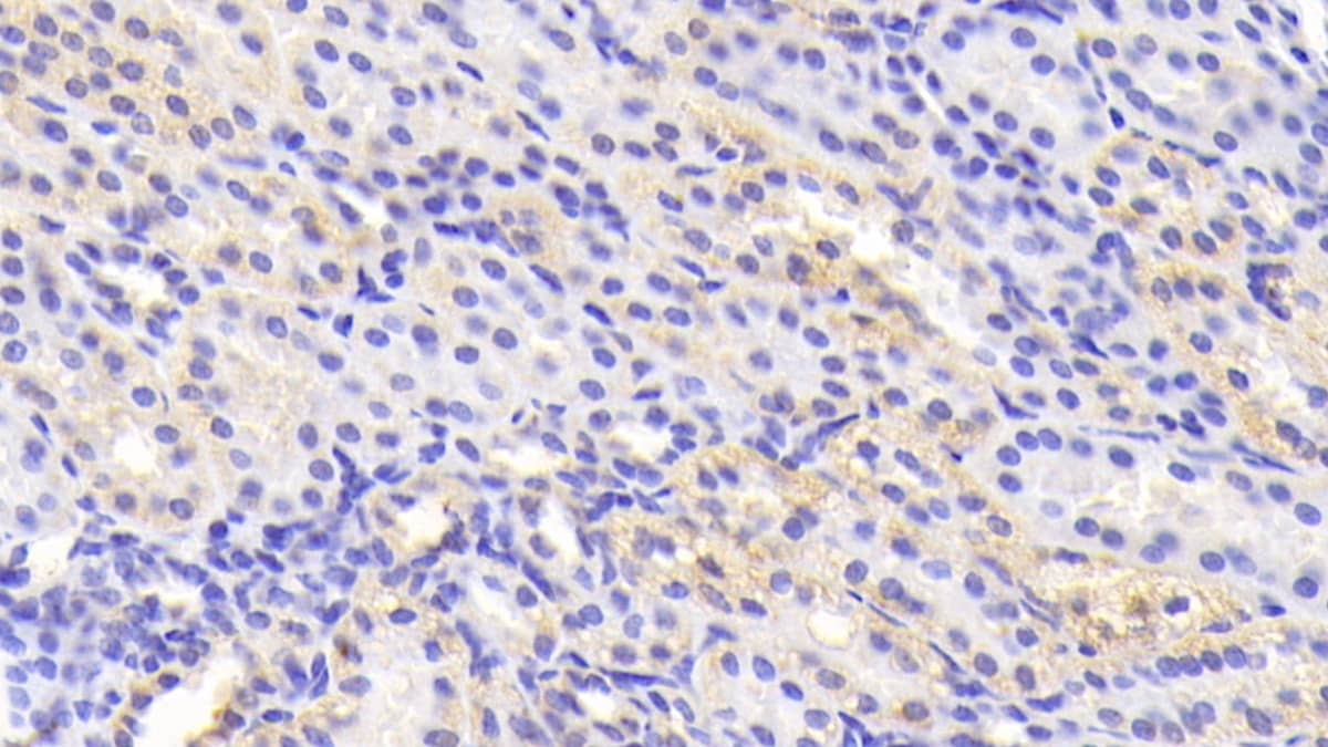 Immunohistochemistry-Paraffin TNKS2 Antibody