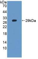 Western Blot TNKS2 Antibody