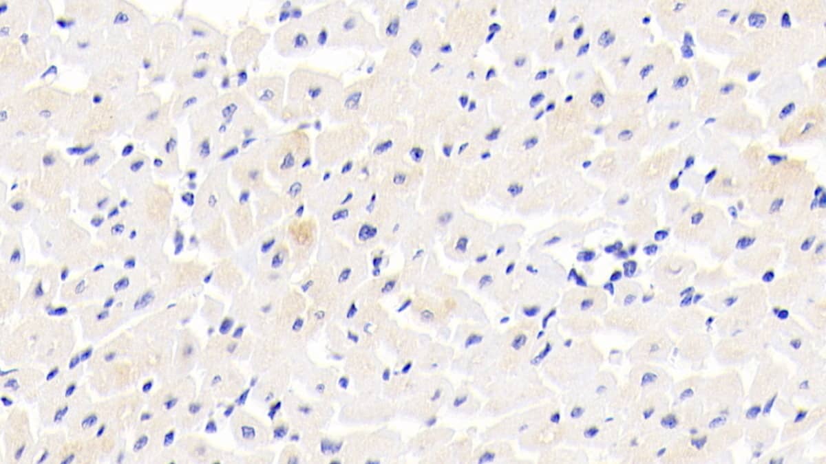 Immunohistochemistry-Paraffin COL14A1 Antibody - BSA Free