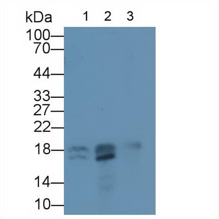 Western Blot: TNNC2 Antibody [NBP3-41245] - Sample: Lane1: Porcine Skeletal muscle lysate; Lane2: Mouse Skeletal muscle lysate; Lane3: Mouse Eye lysate; Primary Ab: 1ug/mL NBP3-41245; Second Ab: 0.2ug/mL HRP-Linked Caprine Anti-Rabbit IgG Polyclonal Antibody