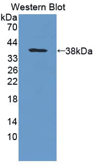 Western Blot PTP gamma/PTPRG Antibody