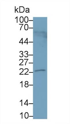 Western Blot: PRL-3/PTP4A3 Antibody [NBP3-41248] - Sample: 293T cell lysate Primary Ab: 1ug/ml NBP3-41248; Second Ab: 0.2ug/mL HRP-Linked Caprine Anti-Rabbit IgG Polyclonal Antibody