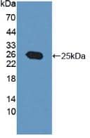 Western Blot: PRL-3/PTP4A3 Antibody [NBP3-41248] - Sample: Recombinant PRL-3/PTP4A3, Human.