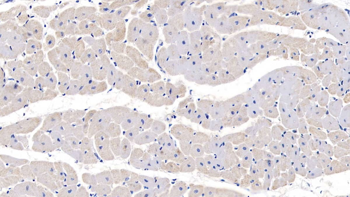 Immunohistochemistry-Paraffin: PRL-3/PTP4A3 Antibody [NBP3-41248] - DAB staining on IHC-P; Samples: Human Cardiac Muscle Tissue; Primary Ab: 20ug/ml NBP3-41248; Second Ab: 2ug/mL HRP-Linked Caprine Anti-Rabbit IgG Polyclonal Antibody