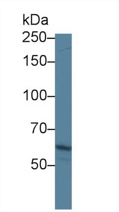 Western Blot: ABCA3 Antibody [NBP3-41249] - Sample: Human A549 cell lysate; Primary Ab: 1ug/ml NBP3-41249; Second Ab: 0.2ug/mL HRP-Linked Caprine Anti-Rabbit IgG Polyclonal Antibody