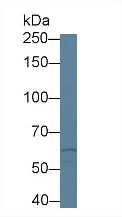 Western Blot ABCA3 Antibody - BSA Free