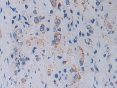 Immunohistochemistry-Paraffin Topoisomerase III alpha Antibody