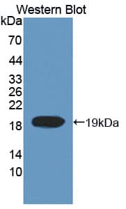 Western Blot Topoisomerase III alpha Antibody