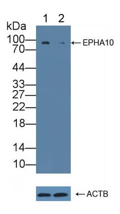 <b>Genetic Strategies Validation. </b>Western Blot: EphA10 Antibody [NBP3-41254] - Knockout Validation: Lane 1: Wild-type K562 cell lysate; Lane 2: EPHA10 knockout K562 cell lysate; Predicted MW: 32,97,110kd ; Observed MW: 90kd; Primary Ab: 1ug/ml NBP3-41254; Second Ab: 0.2ug/mL HRP-Linked Caprine Anti-Rabbit IgG Polyclonal Antibody;
