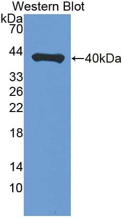 Western Blot P4HA3 Antibody