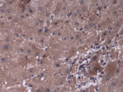 Immunohistochemistry-Paraffin P4HA3 Antibody