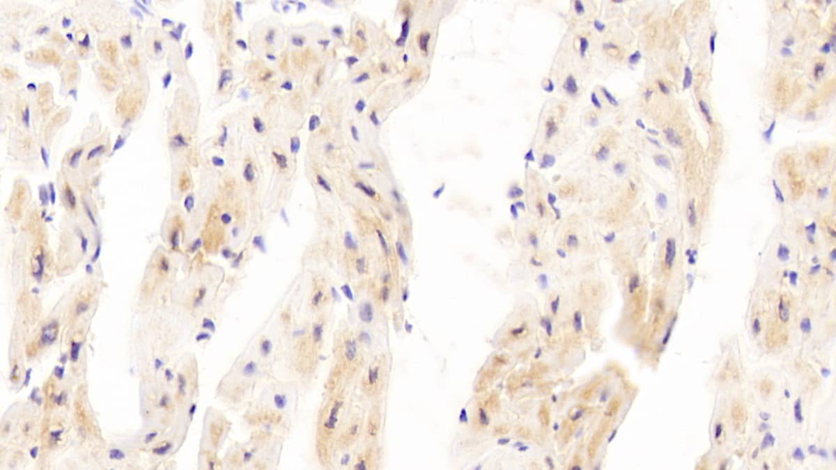 Immunohistochemistry-Paraffin P4HA3 Antibody