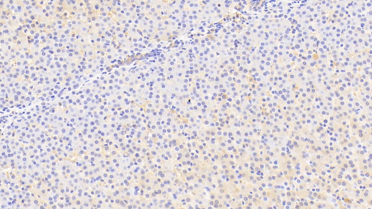 Immunohistochemistry-Paraffin SLC25A37 Antibody