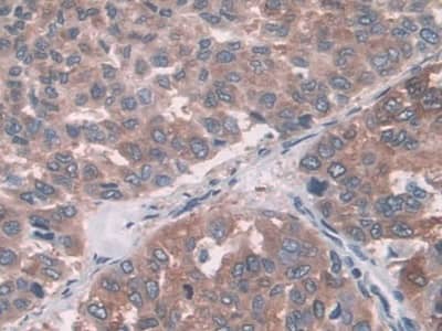 Immunohistochemistry-Paraffin FUT6 Antibody