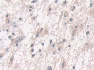 Immunohistochemistry-Paraffin FUT6 Antibody