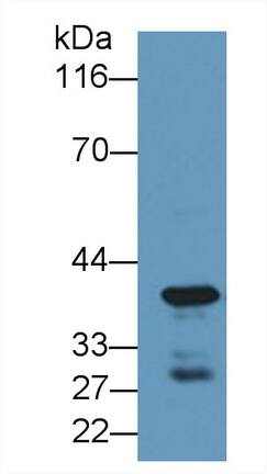 Western Blot: Carboxypeptidase A4/CPA4 Antibody [NBP3-41263] - Sample: Human Lung lysate Primary Ab: 1ug/ml NBP3-41263; Second Ab: 0.2ug/mL HRP-Linked Caprine Anti-Rabbit IgG Polyclonal Antibody