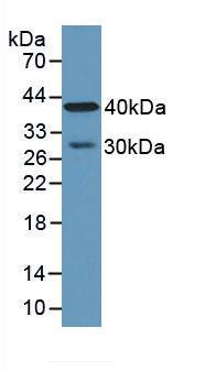 Western Blot: Carboxypeptidase A4/CPA4 Antibody [NBP3-41263] - Sample: Human Lung Tissue.