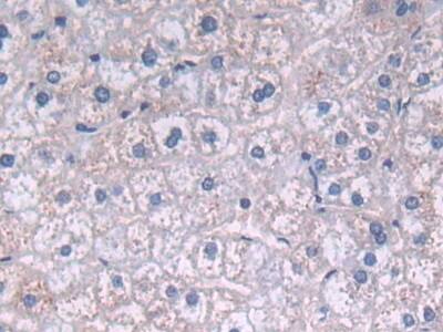 Immunohistochemistry-Paraffin Fatty acid desaturase 2 Antibody