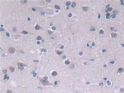 Immunohistochemistry-Paraffin Fatty acid desaturase 2 Antibody