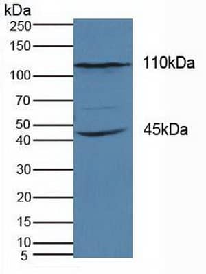 Western Blot: KIF18A Antibody [NBP3-41266] - Sample: Human Hela Cells.