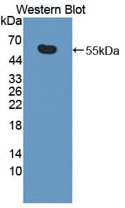 Western Blot: KIF18A Antibody [NBP3-41266] - Sample: Recombinant KIF18A, Human.