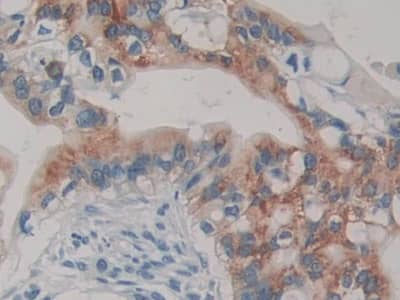 Immunohistochemistry-Paraffin TMPRSS4 Antibody