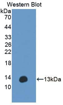 Western Blot ANO6 Antibody