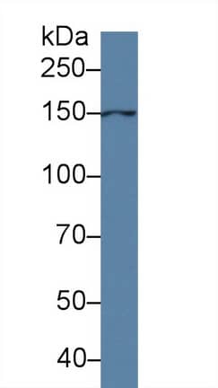 Western Blot ANO6 Antibody