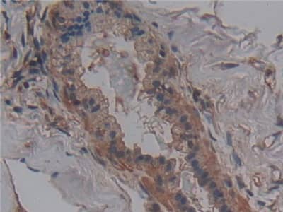 Immunohistochemistry-Paraffin ANO6 Antibody