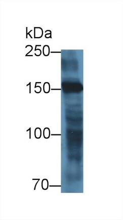 Western Blot Myomesin 2 Antibody