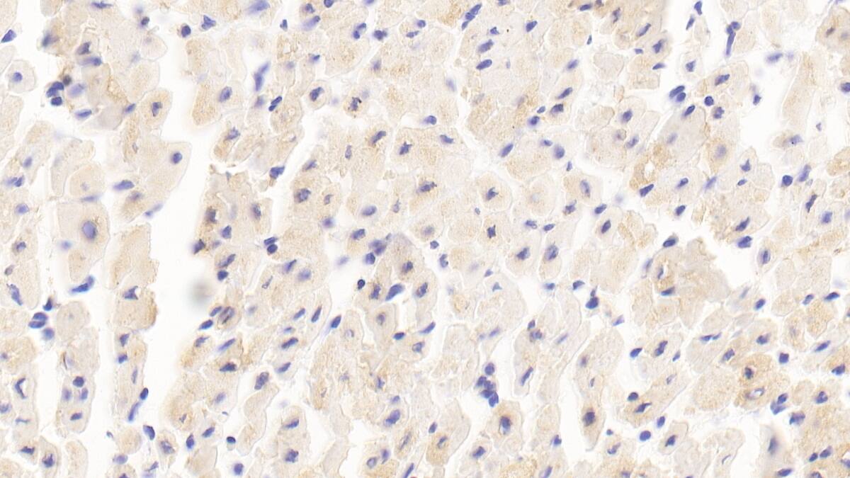 Immunohistochemistry-Paraffin Myomesin 2 Antibody