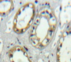 Immunohistochemistry-Paraffin: PLVAP Antibody [NBP3-41275] - Used in DAB staining on fromalin fixed paraffin-embedded kidney tissue