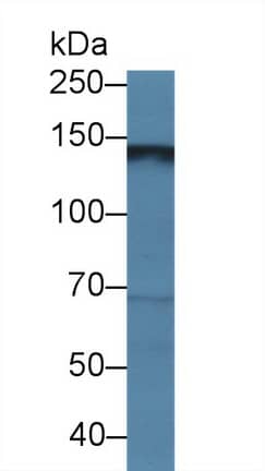 Western Blot Hephaestin Antibody