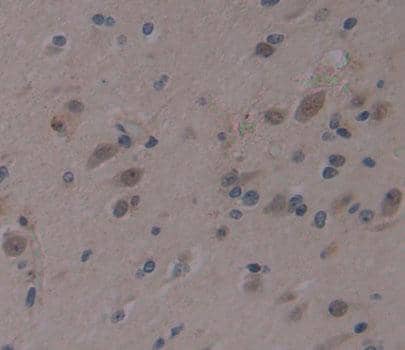 Immunohistochemistry-Paraffin AHRR Antibody