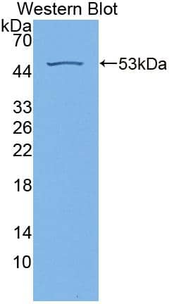 Western Blot: RS1 Antibody [NBP3-41282] - Sample: Recombinant RS1, Human.