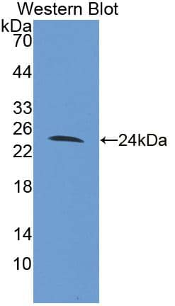 Western Blot: FAM20A Antibody [NBP3-41283] - Sample: Recombinant protein.