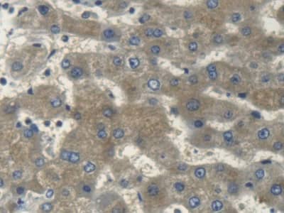 Immunohistochemistry-Paraffin: Myosin heavy chain 14 Antibody [NBP3-41284] - DAB staining on IHC-P; Samples: Human Liver Tissue; Primary Ab: 20ug/ml NBP3-41284; Second Ab: 2ug/mL HRP-Linked Caprine Anti-Rabbit IgG Polyclonal Antibody