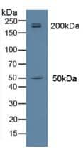 Western Blot: Myosin heavy chain 14 Antibody [NBP3-41284] - Sample: Rat Brain Tissue.