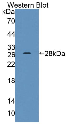 Western Blot: Nicotinic Acetylcholine R alpha 3/CHRNA3 Antibody [NBP3-41285] - Sample: Recombinant Nicotinic Acetylcholine R alpha 3/CHRNA3, Human.