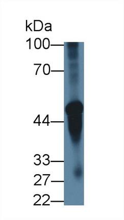 Western Blot: Nicotinic Acetylcholine R alpha 3/CHRNA3 Antibody [NBP3-41285] - Sample: Mouse Cerebellum lysate; Primary Ab: 5ug/ml NBP3-41285; Second Ab: 0.2ug/mL HRP-Linked Caprine Anti-Rabbit IgG Polyclonal Antibody