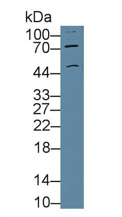 Western Blot: Nicotinic Acetylcholine R alpha 3/CHRNA3 Antibody [NBP3-41285] - Sample: Mouse Cerebrum lysate; Primary Ab: 5ug/ml NBP3-41285; Second Ab: 0.2ug/mL HRP-Linked Caprine Anti-Rabbit IgG Polyclonal Antibody