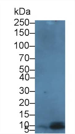 Western Blot beta-Defensin 3 Antibody