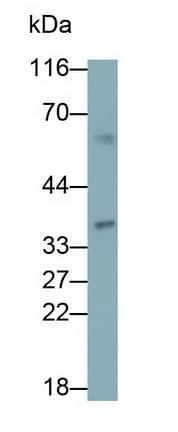 Western Blot BCMO1 Antibody