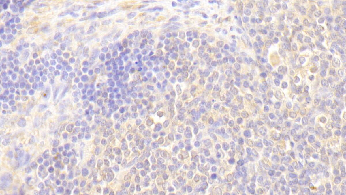 Immunohistochemistry-Paraffin: Blk Antibody [NBP3-41291] - DAB staining on IHC-P; Samples: Human Lymph node Tissue; Primary Ab: 20ug/ml NBP3-41291; Second Ab: 2ug/mL HRP-Linked Caprine Anti-Rabbit IgG Polyclonal Antibody