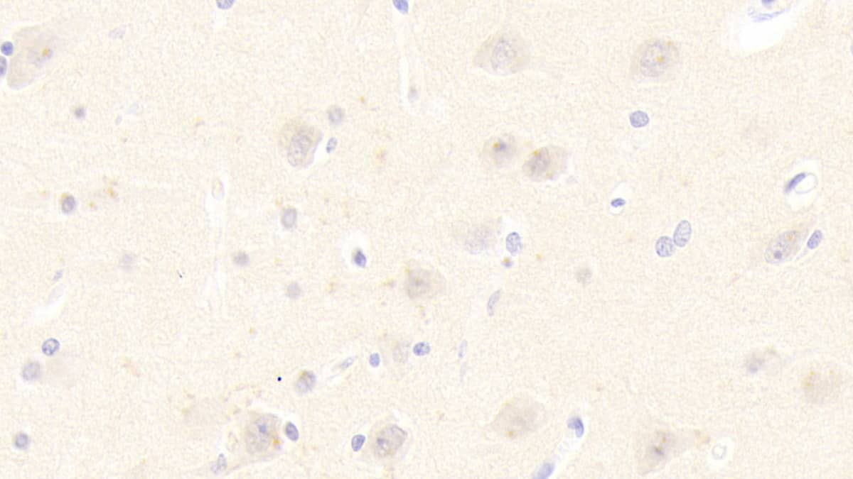 Immunohistochemistry-Paraffin: DNAJC4 Antibody [NBP3-41293] - DAB staining on IHC-P; Samples: Human Cerebrum Tissue; Primary Ab: 20ug/ml NBP3-41293; Second Ab: 2ug/mL HRP-Linked Caprine Anti-Rabbit IgG Polyclonal Antibody